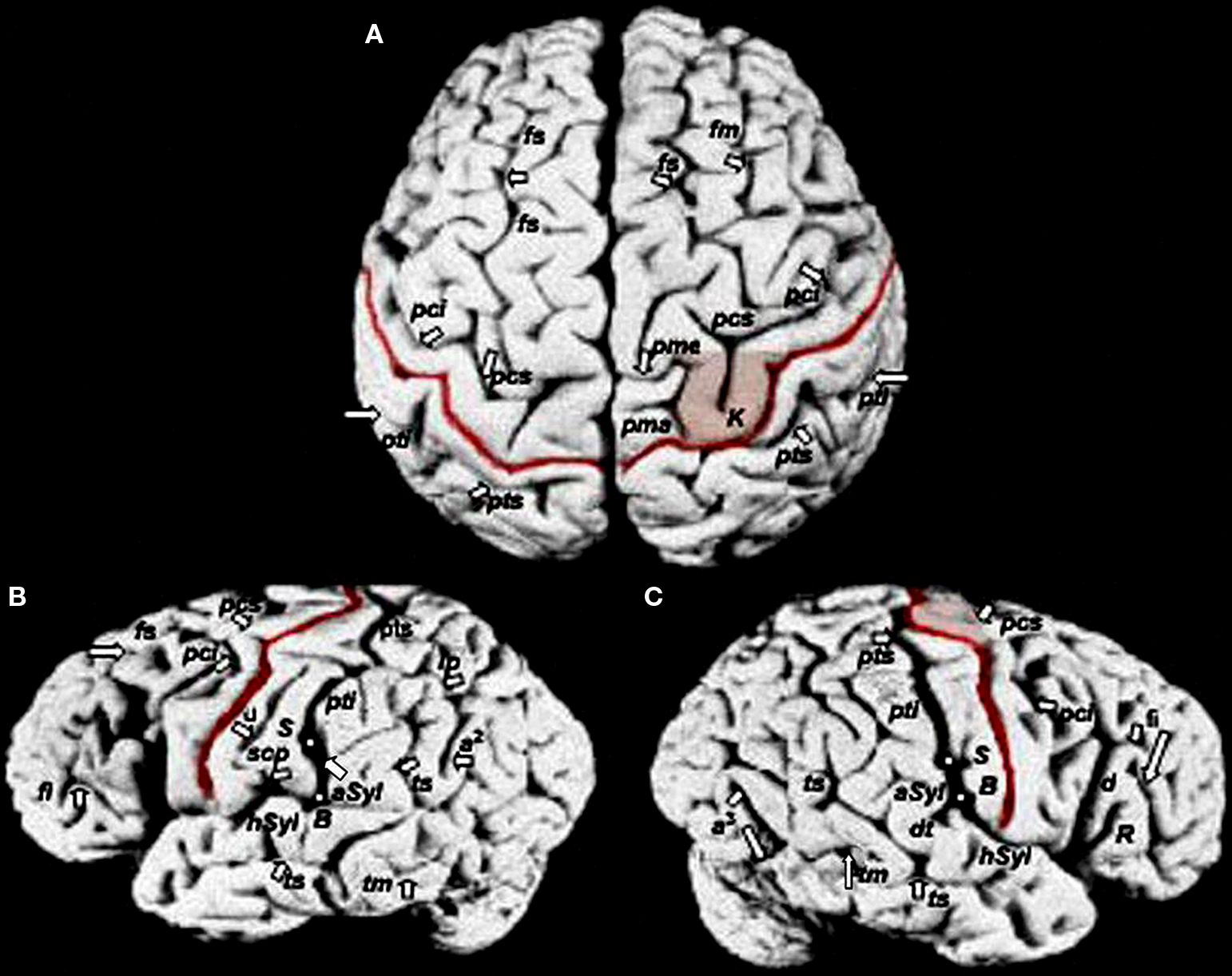 Fotografía del cerebro de Einstein