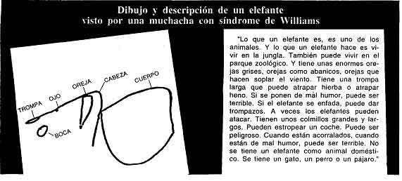 El síndrome de Williams El síndrome de Williams