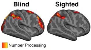 Zonas de procesamiento numérico en personas ciegas (izda.) y videntes (dcha.). Fuente: Universidad Johns Hopkins.