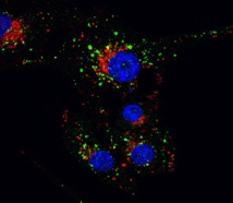 Efecto del tratamiento con THC en los autofagosomas (verde) y lisosomas (rojo) de células de glioma. Imagen: Guillermo Velasco. Fuente: UCM.