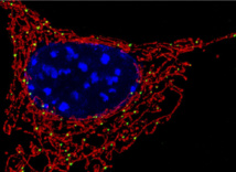 Las mitocondrias (en color rojo) son orgánulos que dotan de energía a la célula. Imagen: NICHD. Fuente: UCM.