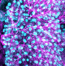 © Institut de la vision © Institut de la vision