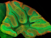 En verde las células granulares del cerebelo. Imagen: Mark Wagner.