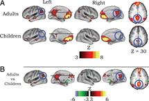 Diferencias entre el cerebro de los niños y el de los adultos.
