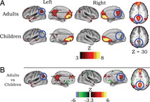 Diferencias entre el cerebro de los niños y el de los adultos. Diferencias entre el cerebro de los niños y el de los adultos.