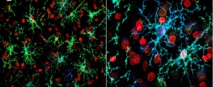 Celulas cutáneas y células cerebrales. Credit: McGill University
