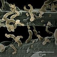 Nanobacterias