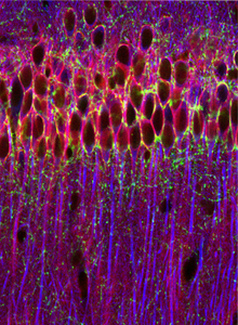Efectos del cannabis en las neuronas. Foto: Universitat Pompeu Fabra