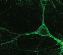 Neurona de ratón que expresa el gen de la proteína Arch. Fuente: MIT.