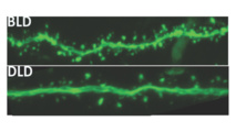 Efectos de la luz tenue (DLD) y de la luz brillante (BLD) en el cerebro de las ratas del experimento. Foto: Michigan State University.