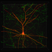 Imagen virtual de una neurona para su reclasificación. Imagen: FIUPM.