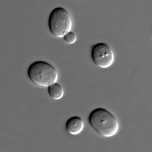 Imagen de células de levadura de cerveza (Sacharomyces cerevisiae) tomada con microscopio. Fuente: Wikimedia Commons.