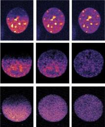 Células en distintas etapas de la división celular detectadas por Micropilot. Fuente: EMBL