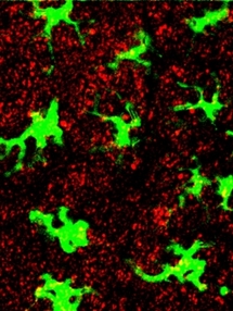 Células inmunes, señaladas con una proteína verde fluorescente, rodeadas por nanopartículas (rojas), depués de que éstas hayan sido inyectadas bajo la piel de un ratón. Fuente: MIT.