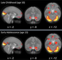 Actividad cerebral registrada con la IMRf, a los 10 y a los 13 años. Fuente: Universidad de Oregón.