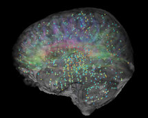 El Allen Human Brain Atlas permitirá a los investigadores ver en qué partes del cerebro están expresados los genes individuales (los puntos en colores cálidos representan una expresión elevada de genes). Fuente: Allen Institute.