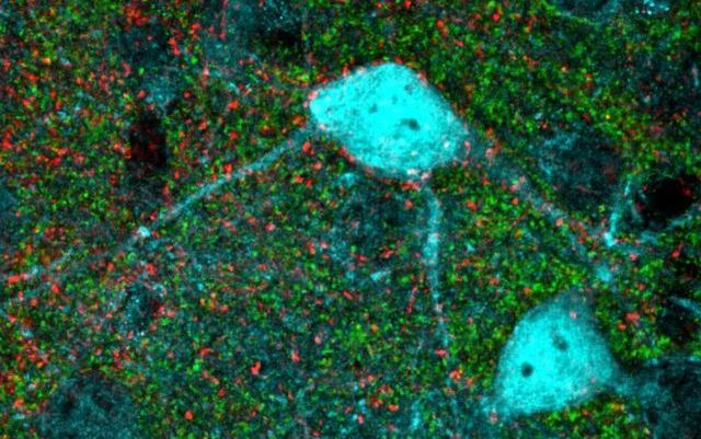 Los puntos rojos son las sinapsis de larga distancia. Imagen Tufts University School of Medicine.