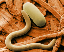 Microfotografía coloreada de un nematodo. Fuente: Wikimedia Commons.
