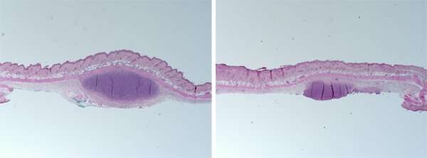 Piel de ratón tratada con sebo humano sintético, administrada con cepas de Cutibacterium acnes asociada a acné (izquierda) o Cutibacterium acnes asociada a la piel sana (derecha). Imagen: UC San Diego Health.
