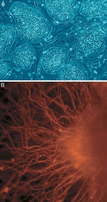 Células madre embrionarias humanas. A. Colonias de células aún no diferenciadas. B. Células nerviosas. Fuente: Wikimedia Commons.