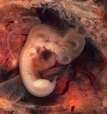 Embrión humano en la séptima semana de desarrollo. Fuente: WIkimedia Commons.