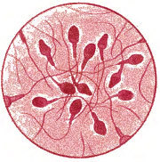 Esperma. Fuente: The Turek Clinic. Esperma. Fuente: The Turek Clinic.