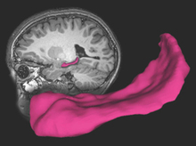 Hipocampo, en fucsia. Fuente: Universidad de Washington. Hipocampo, en fucsia. Fuente: Universidad de Washington.