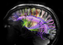 La organización neuronal  traza caminos en forma de rejilla. Imagen: MGH UCLA Human Connectome Project