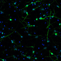 Neuronas estudiadas por los investigadores del INc. En color verde, las que tienen silenciado el gen Nurr1. Fuente: UAB.