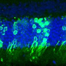 Las células fotorreceptoras trasplantadas (en verde) pueden integrarse y formar conexiones funcionales en la retina de un ratón adulto ciego, y devolverle la visión. Imagen: Robin Ali. Fuente: UCL.