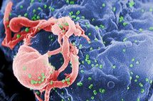 Viriones de VIH-1 (en verde) ensamblándose en la superficie de un linfocito. Fuente: Wikimedia Commons.