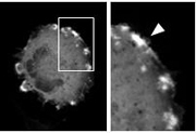 Al conectarse las proteínas FRB y FKBP o la GID1 y la GAI, las membranas de las células desarrollaron unos volantes que pudieron observarse con el microscopio. Fuente: John Hopkins Medicine.
