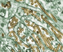 Virus H5N1 (en dorado) creciendo en células (en verde). Fuente: Wikimedia Commons.