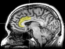 Corte MRI sagital con indicación de la ubicación del cortex del cíngulo anterior. Fuente: Wikimedia Commons.