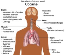 Los efectos de la cocaína. Imagen:	Mikael Häggström. Click para ampliar.