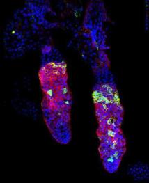 Tinción del reortero transgénico Keratin-15-GFP (verde) en la epidermis de la cola de un ratón muestra la población de células madre que muestra cambios asociados con la vejez. En rojo,la proteína keratin 15 y en azul la tinte fluorescente DAPI. Fuente: CRG.