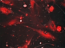 Liberación controlada de la molécula fluorescente rodamina en fibroblastos senescentes de pacientes con disqueratosis congenita, mediante el nanodispositivo. Fuente: CSIC.
