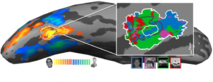 Actividad de la FFA (bordeada en blanco) según las imágenes presentadas (definidas en colores). Fuente: Universidad de Vanderbilt.