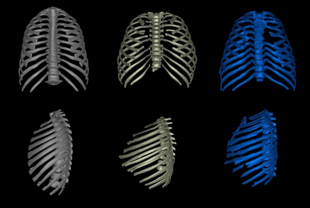 Comparativa de las cajas torácicas de un ser humano moderno, un erectus y un neandertal. M. Bastir