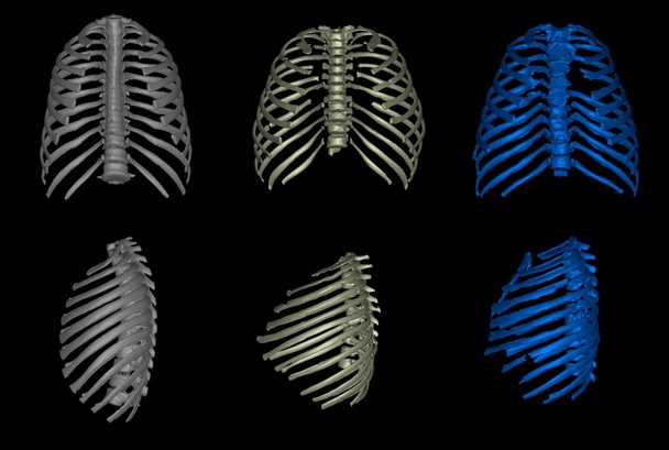 Comparativa de las cajas torácicas de un ser humano moderno, un erectus y un neandertal. M. Bastir Comparativa de las cajas torácicas de un ser humano moderno, un erectus y un neandertal. M. Bastir