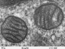 Mitocondrias. Fuente: Wikimedia Commons.
