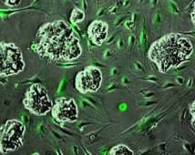 Imagen microscópica de células de cáncer de colon en crecimiento rodeadas por células del estroma, principalmente fibroblastos (en verde). Imagen: Alexandre Calon. Fuente: IRB.