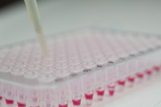 El estudio sobre la vacuna de ADN para la leucemia muestra buenos resultados preliminares. Fuente: Universidad de Southampton.