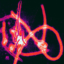 Micrografía electrónica de color realzado de partículas de virus del Ébola. Imagen: PLoS Pathogens.