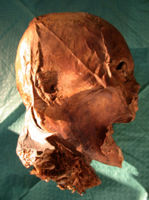 Cabeza momificada de Enrique IV. Imagen: Philippe Charlier. Fuente:  CSIC.