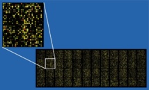 Ejemplo de un chip de ADN con 37.500 sondas. Imagen: Paphrag. Fuente: Wikipedia.