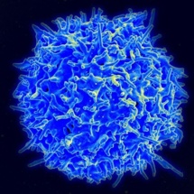 Micrografía de una célula T del sistema inmune de un donante sano. Imagen: NIAID/NIH. Fuente: Wikimedia Commons.