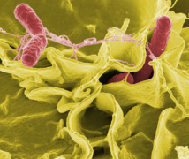 Las bacterias podrían ser convertirdas en fábricas microscópicas que mejoren la salud de los pacientes, gracias a la biología sintética. Fuente: Wikimedia Commons.