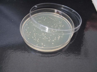 Placa Petri con colonias de bacterias creciendo en un sustrato azaroso. Fuente: UGR.