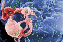 Viriones de VIH-1 (en verde) ensamblándose en la superficie de un linfocito. Imagen: C. Goldsmith. Fuente: Wikimedia Commons.
